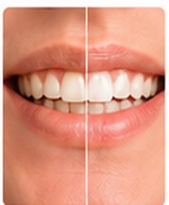 whitening-touchup